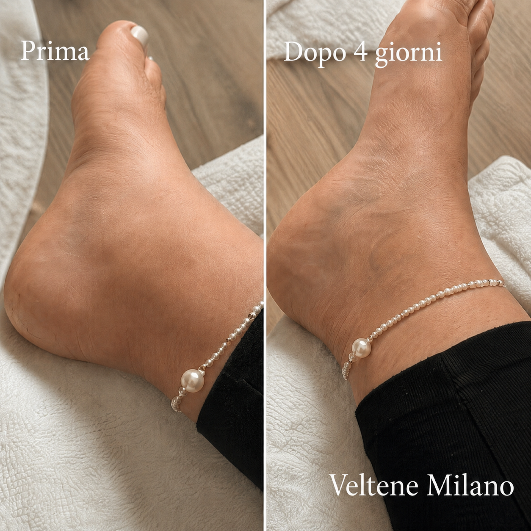 Calze compressive